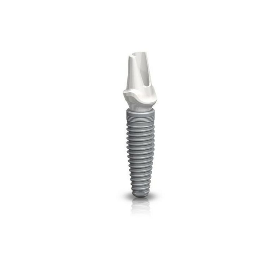 Implant i abatmant zuba